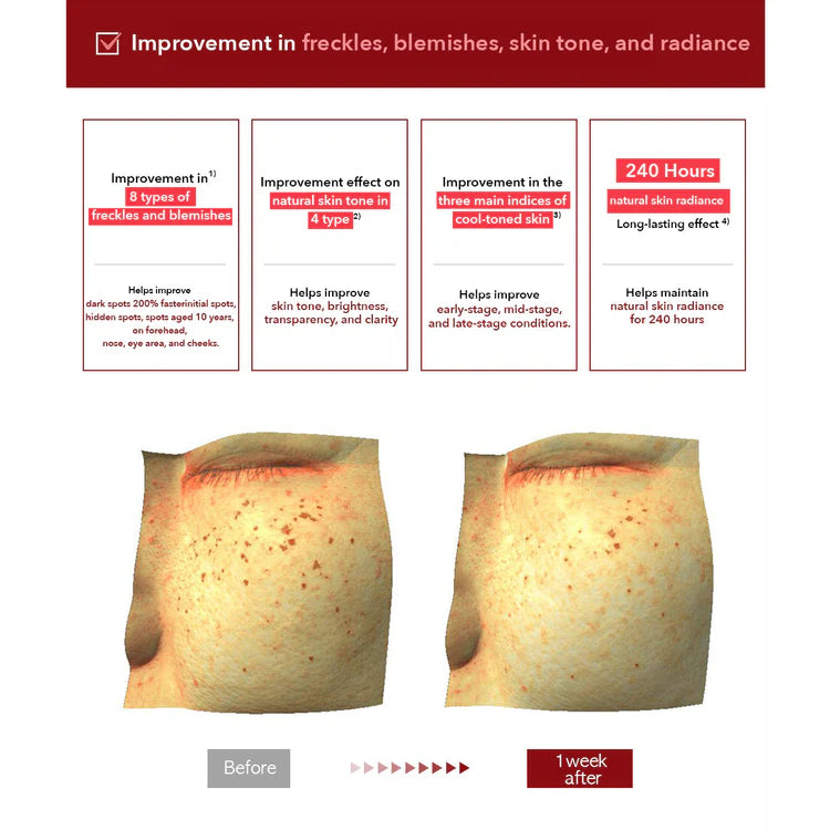 Before and after comparison of skin with freckles and blemishes, showing improvement effects on skin tone and radiance.