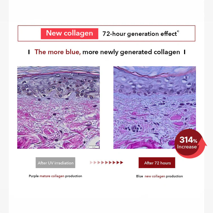 Comparison of collagen production before and after 72 hours with blue new collagen production, showing a 314% increase.