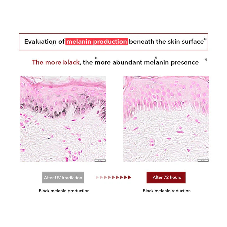 Microscopic images showing melanin production before and after UV irradiation with text explaining melanin reduction.